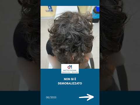 Matteo Giovani-35