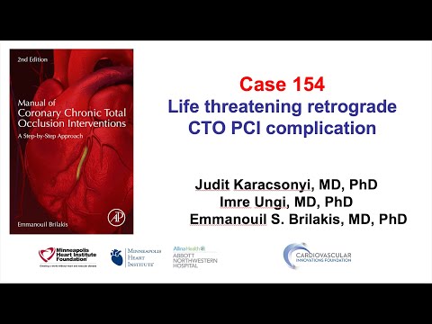 Case 154: Manual of CTO PCI: Perils of retrograde