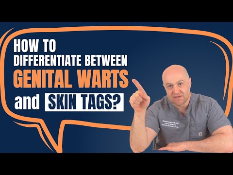 How to differentiate between genital warts and skin tags