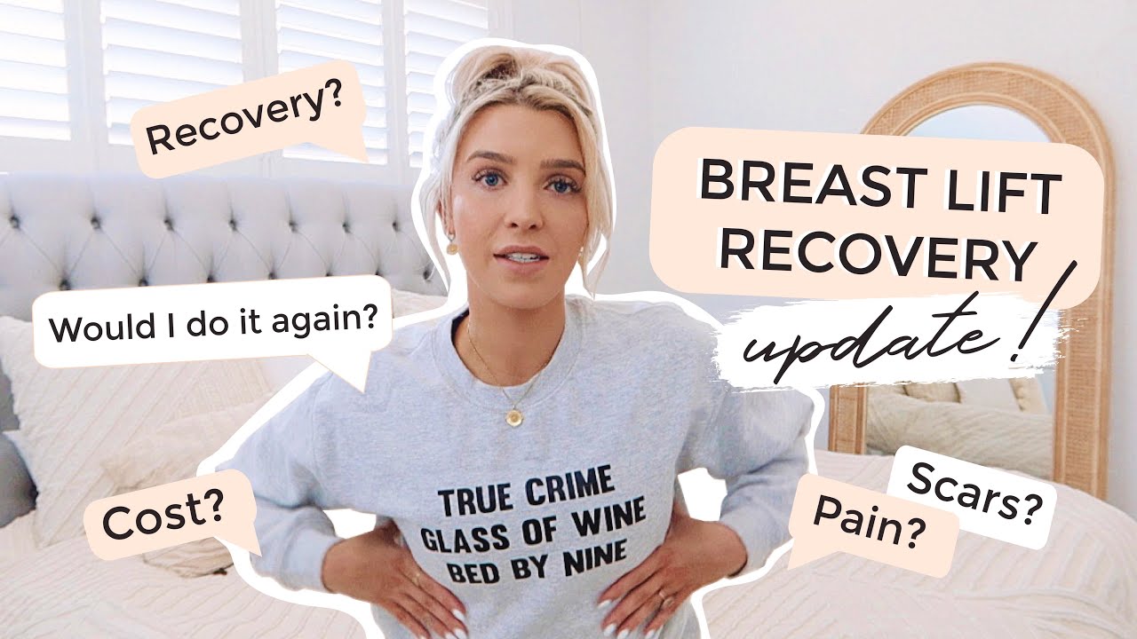 BREAST LIFT UPDATE// SEE MY SCARS/ PAIN/ WOULD I DO IT AGAIN 5 Months Post-Surgery