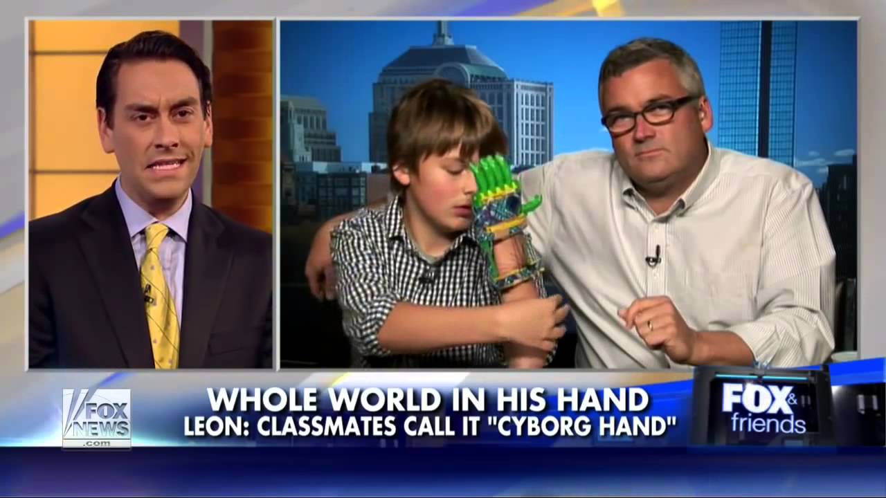 Father makes son's prosthetic hand with 3D printer