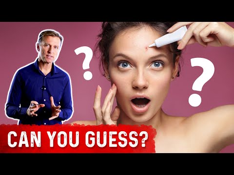 Which Vitamin Deficiency Causes Chapped Cracked Lips – Dr Berg