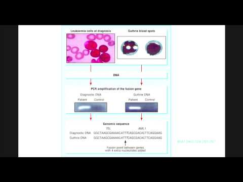 Timing of Events (genetic and epigenetic) and Leukemia - Dr. Joseph Wiemels
