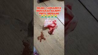 Download lagu BILQIS TANGANNYA BERDARAH 😱😱😱😭😭😭 #bilqisishratv #trend #lfl #viral #fypシ #modelcilik #viralvideo mp3