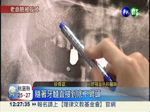 牙根沒拔乾淨 7旬嬤差點沒命