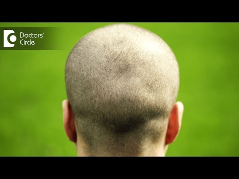 Finasteride 2.5mg Tablets