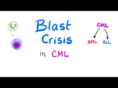 Blast Crisis in Chronic Myeloid Leukemia (CML) - When Chronic Myeloid Leukemia Goes Mad! -Hematology