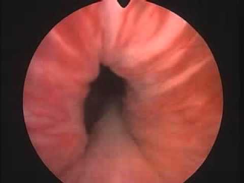 Tocopherol für Prostata Patch für die Behandlung von Prostatitis und BPH
