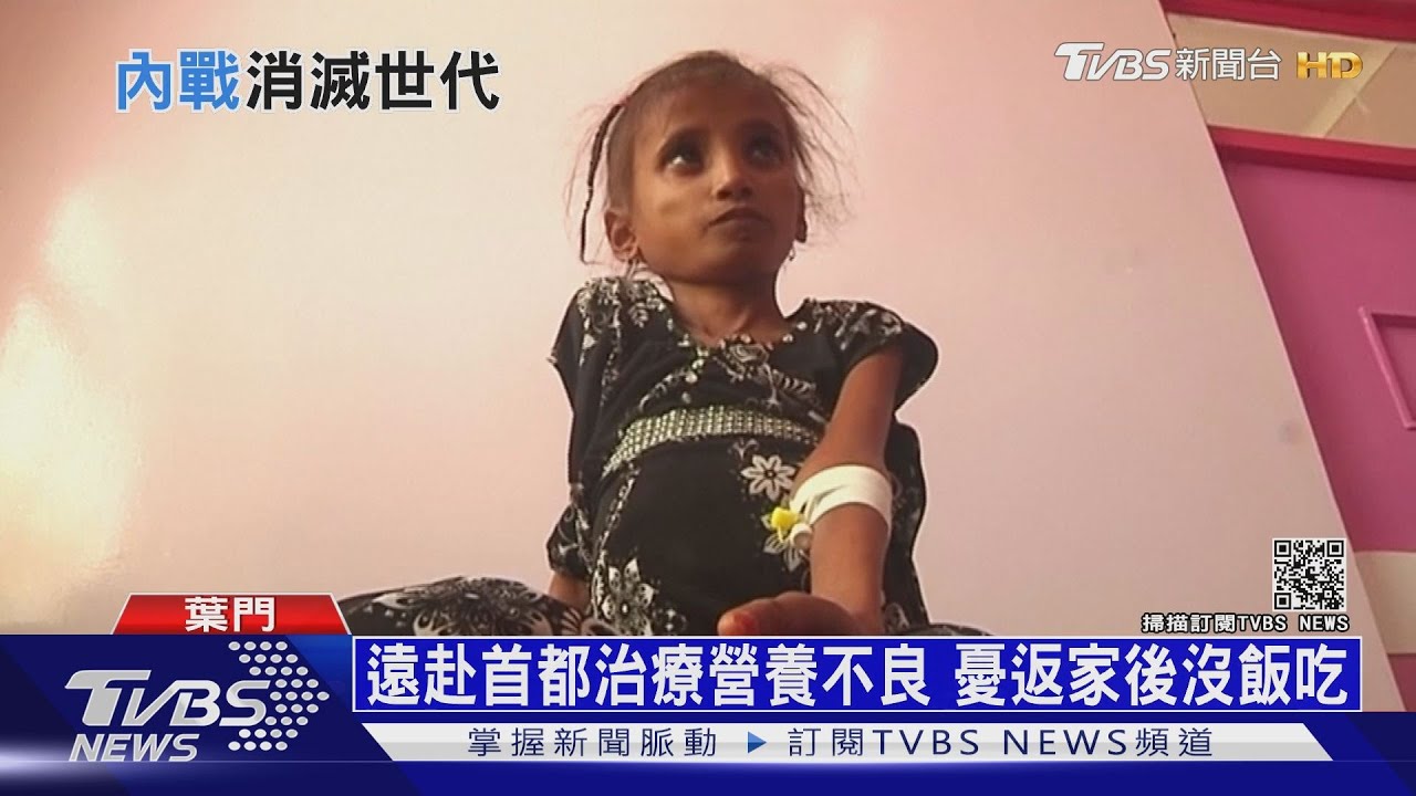 葉門內戰饑荒加劇 40萬名兒童恐營養不良死亡