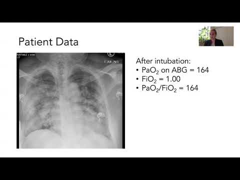 COVID-19 ARDS Diagnosis and Management Part 1