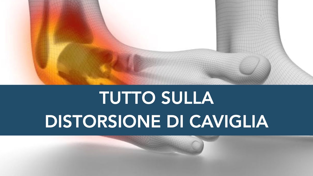 Watch Now DISTORSIONE DI CAVIGLIA: tutto quello che devi sapere DISTORSIONE DI CAVIGLIA: tutto quello che devi sapere