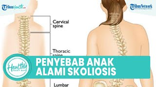 Penyebab Anak Alami Skoliosis Sebelum Masa Pubertas, Satu di Antaranya Cedera Tulang Belakang