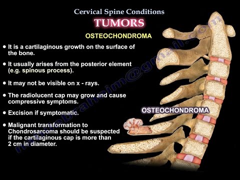 Alezan für Pferde für gemeinsame Bewertungen Osteochondrose kann Druck erhöhen
