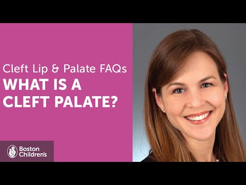 What is a Cleft Palate? | Boston Children’s Hospital