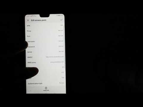 How to Fix Huawei p30/p20 hotspot/mms/ internet /apn issues