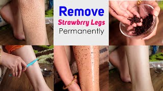 Remove Strawberry Legs Permanently at Home