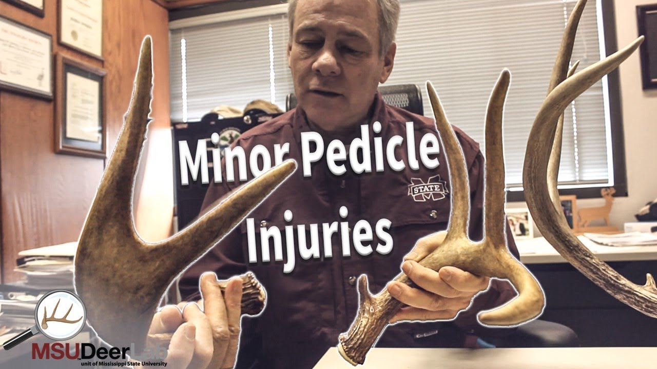 Minor Pedicle Injuries