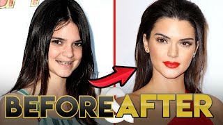Kendall Jenner Glow Up 2019 | Before and After Transformations | KUWTK