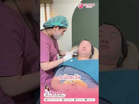 รีวิวหัตถกากระตุ้นคลอลาเจนด้วยโปรแกรม Sculptra