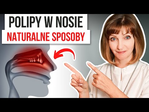 🍀 POLIPY w NOSIE. 🍀 Bez tego nie pozbędziesz się polipów na stałe. Narine