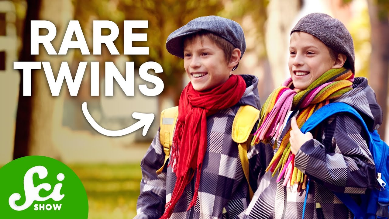 6 Types of Twins That Are Extremely Rare