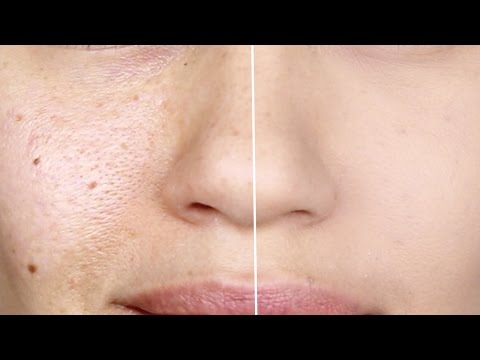 How to make Pores Disappear! | How to make Large Pores Vanish | Eman