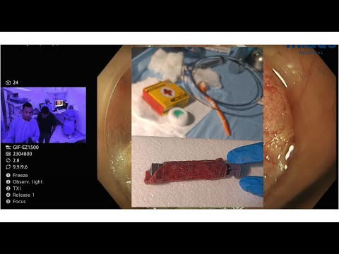 YouTube video