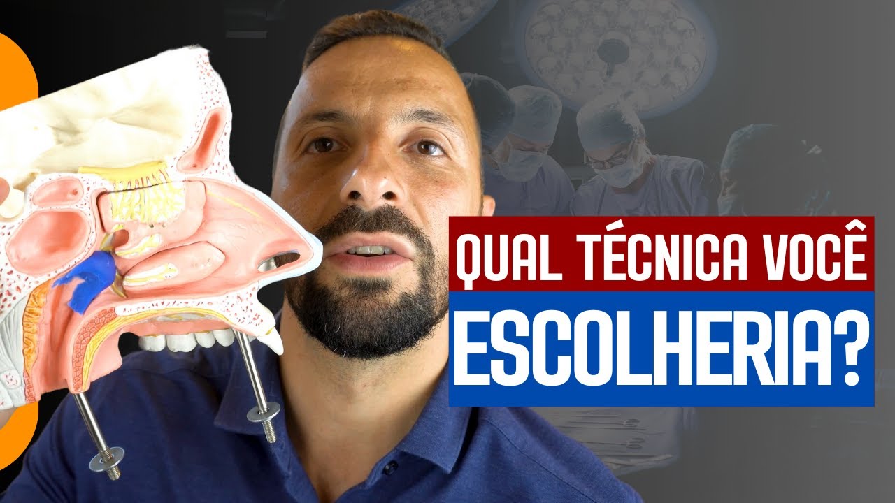QUAL A MELHOR TÉCNICA PARA CIRURGIA DE ADENOIDE?