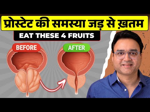 Prostate Enlargement: बढे हुए प्रोस्टेट को सिकोड़ने में मदद करेंगे ये 4 शक्तिशाली फल