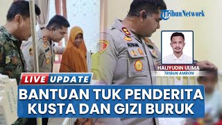 Kapolres SBT Jenguk Anak Penderita Kusta dan Gizi Buruk, Salurkan Bantuan saat Sambangi RSUD Bula