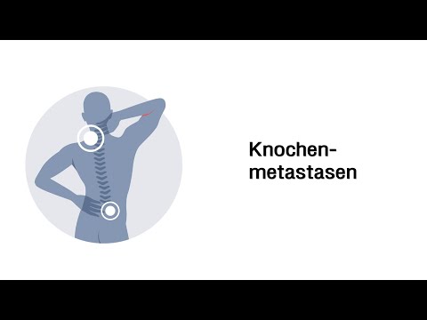 Mittlere Zyste an ihrem Hals Behandlung Ob es möglich ist, schmerzendes Gelenk zu behandeln