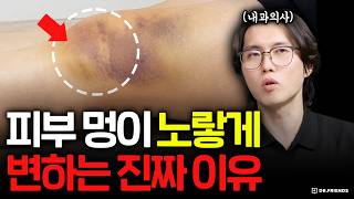 노란 멍의 반전! 피부 탄력을 위해 알아야 할 새로운 항산화 물질