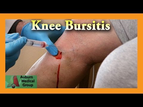 Tintura ad aglio per le articolazioni Medico curante problemi articolari