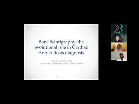 Bone Scintigraphy: The Evolutional Role in Cardiac Amyloidosis Diagnosis