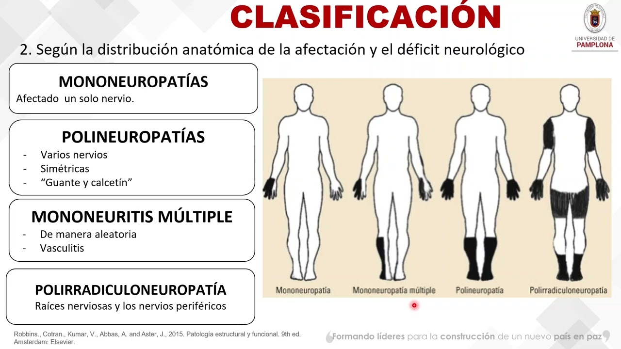 Neuropatías Periféricas [Medicina Interna]