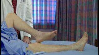 Stroke Scale Certification - Group C - Patient 3