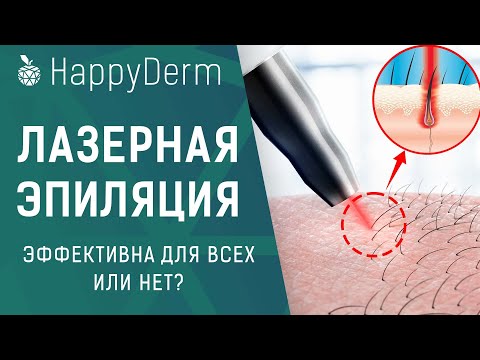 ЛАЗЕРНАЯ ЭПИЛЯЦИЯ. МОЖНО ЛИ ИЗБАВИТЬСЯ ОТ ВОЛОС НАВСЕГДА ПРИ ПОМОЩИ АЛЕКСАНДРИТОВОГО ЛАЗЕРА?