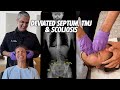 Can Finally Breathe Again Deviated Septum TMJ Scoliosis Feet Pronation Dr Rahim Chiropractic