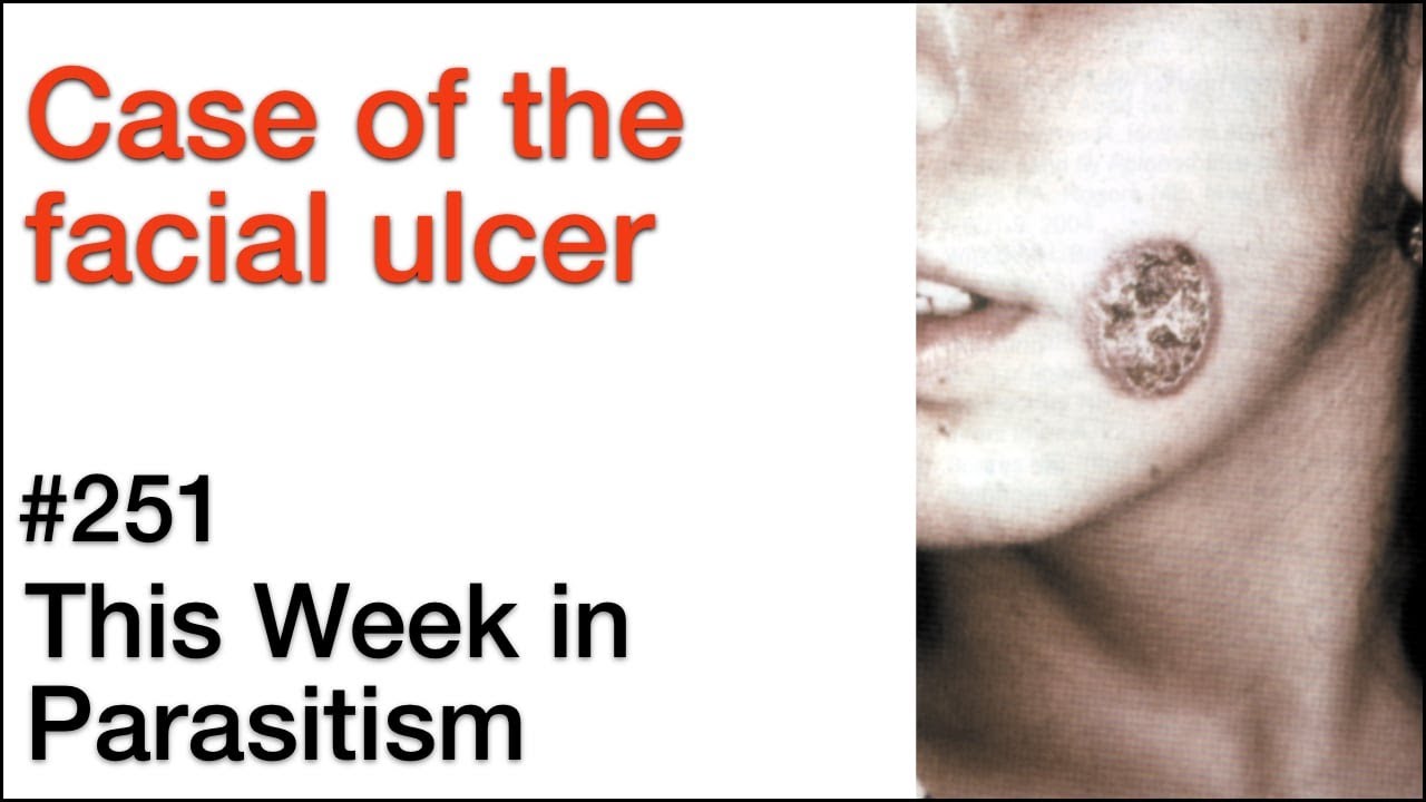 TWiP 251: Case of the facial ulcer