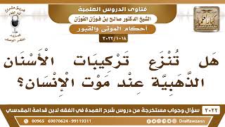 [1018 -3022] هل تنزع تركيبات الأسنان الذهبية عند موت الإنسان؟ - الشيخ صالح الفوزان image