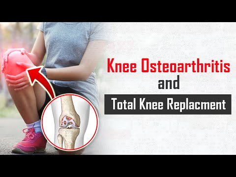 Knee Osteoarthritis And Total Knee Replacement | Mukat Hospital Chandigarh
