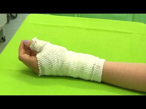 térdízület égési sérülések hogyan lehet ízületeket kialakítani a rheumatoid arthritisben