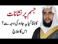 Bruising On Body Jism Pe Nishan Ka Banna Kya Yah Jadu Ki Waja Se Hai Quran Se Rohani Ilaj QRI