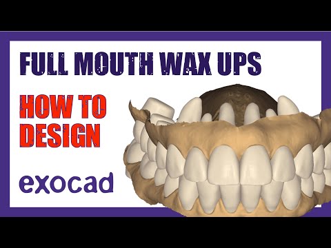 Full Mouth Wax-Up Tutorial | Step-by-Step ExoCAD Design