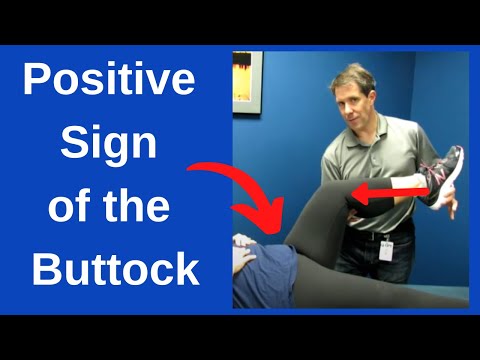 Superior Gluteal Artery Occlusion Mimick Herniated Disc