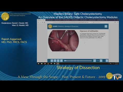 La stratégie de la dissection - Cholécystectomie sûre