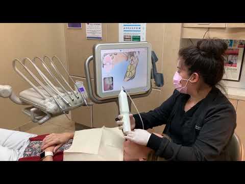 iTero Scanner at Randall Voigt, DDS