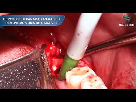 download lagu mp3 mp4 Cisos, download lagu Cisos gratis, unduh video klip Cisos