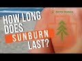 How Long Does Sunburn Last? - Pain and Redness