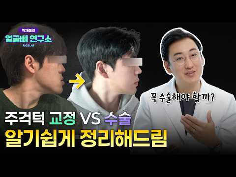 주걱턱 교정 vs 수술? 턱끝 vs 양악? | 주걱턱 해결 방법 총정리